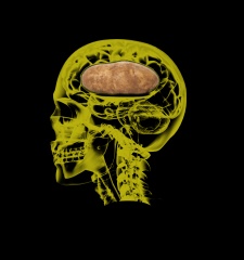 T-Shirt Potato In The Brain